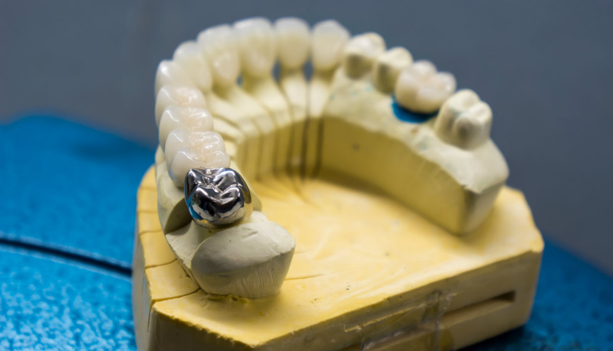 протезировании жевательных зубов