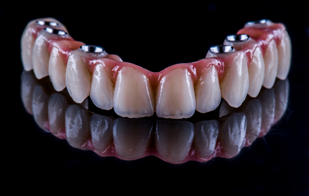 несъемные зубные протезы при полном отсутствии зубов